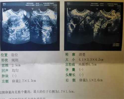 广州供卵代孕哪家好,身体健康女性做试管婴儿成功率是多少-做试管后基础卵泡
