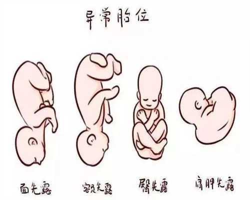 广州代怀孕在哪里:药流一次会影响宫颈腐烂吗
