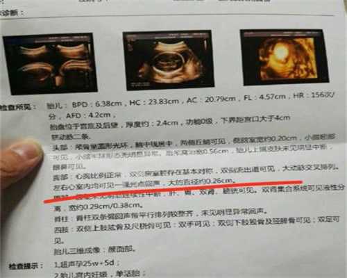 广州代孕需要多少钱:人工授精的成功率比试管婴儿高吗？