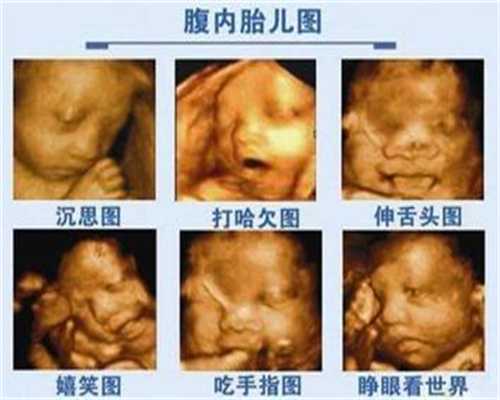 广州代孕中介:美中桥揭秘!为什么海外第三代试管婴儿价格比国内贵？