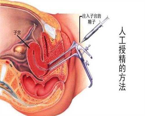 广州哪个医院有代孕_广州找人代孕需要多少钱_环球宝贝最新情况：怎么知道输