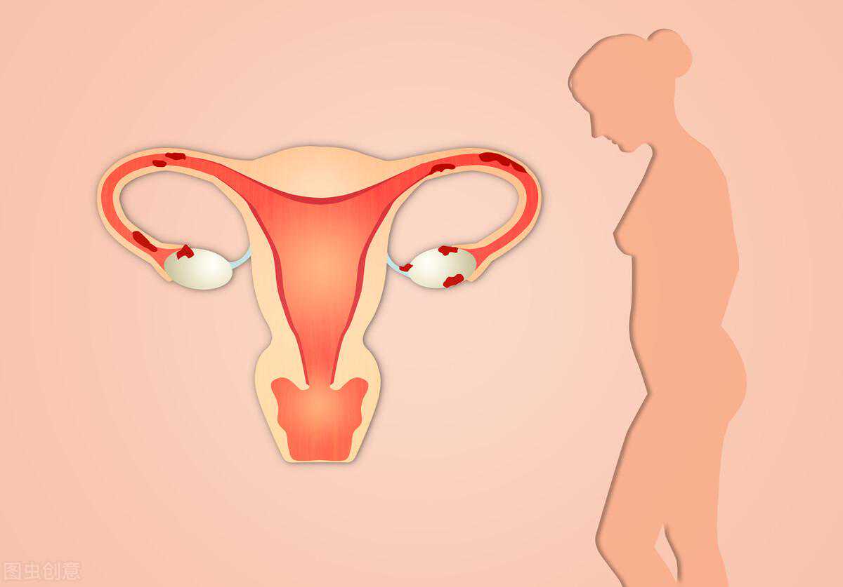 排卵障碍的女性给如何健康备孕?
